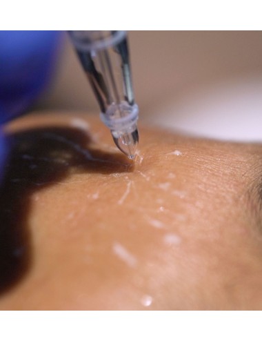 Pièce à main Magic Blueline